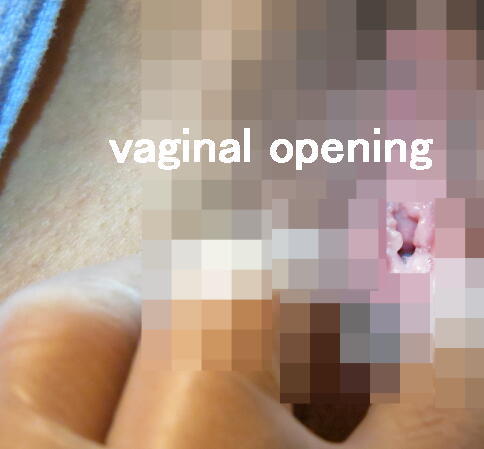 vaginal opening